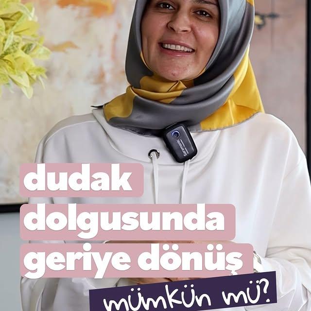 Dudak Dolgusu Sonrası Geri Dönüş İmkanı: Lip Filler Uygulaması Hakkında Bilgilendirme