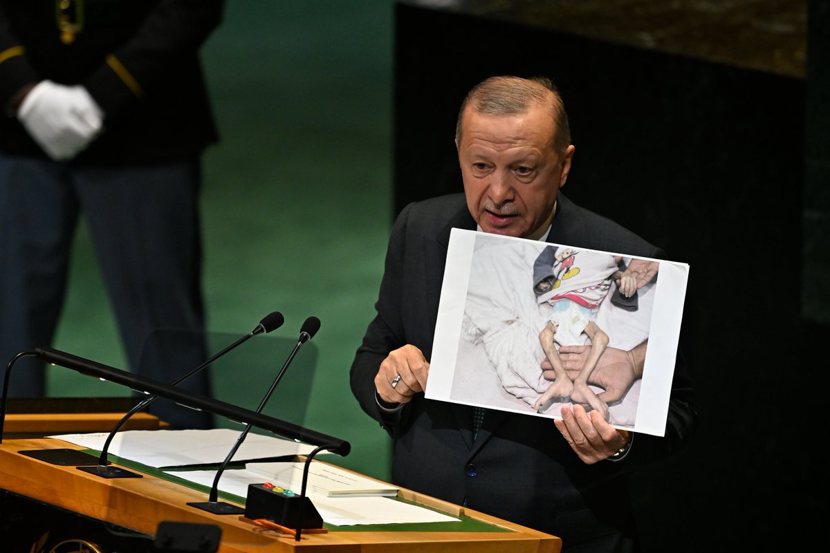 Gazze'de Anestezi Olmadan Amputasyonlar İnsanlığı Sarsıyor